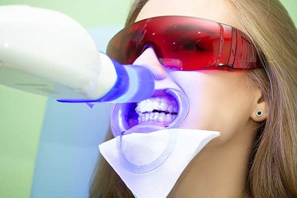 Laser teeth whitening treatments Northamptonshire