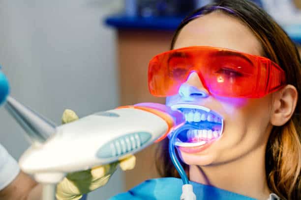 Simplifying Teeth Whitening: A Comprehensive Guide Northamptonshire