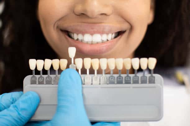 Laser Teeth Whitening: Exploring the Longevity of Your Brighter Smile Northamptonshire