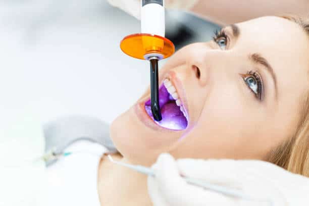 Unveiling the Cost of Laser Teeth Whitening in the UK Northamptonshire