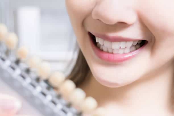 Teeth Whitening Kings Norton Northamptonshire