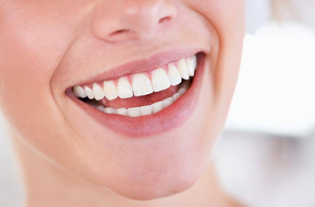 Teeth Whitening West Drayton Northamptonshire