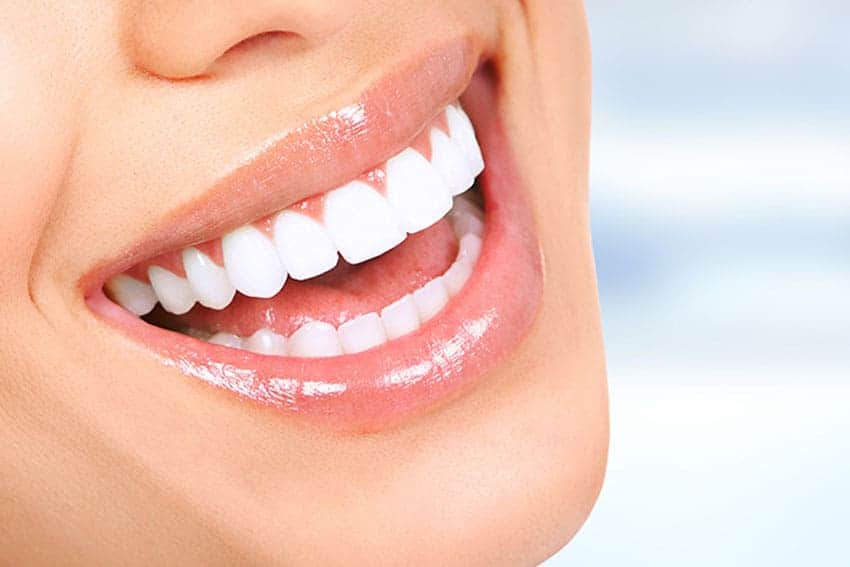 Teeth Whitening Abingdon Northamptonshire